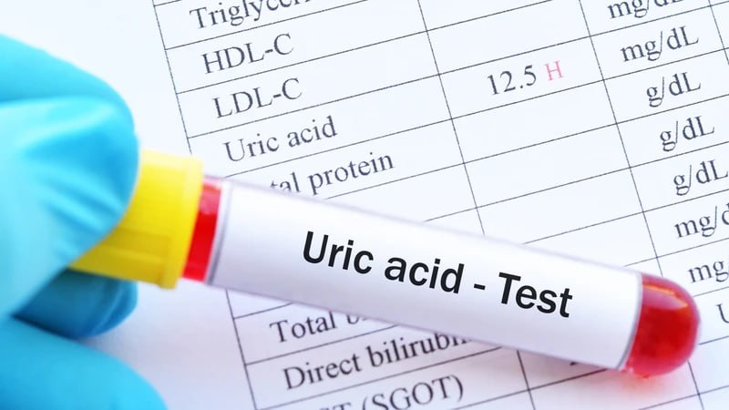 Axit Uric Cao: Nguyên Nhân, Tác Hại Và Cách Kiểm Soát Qua Chế Độ Ăn