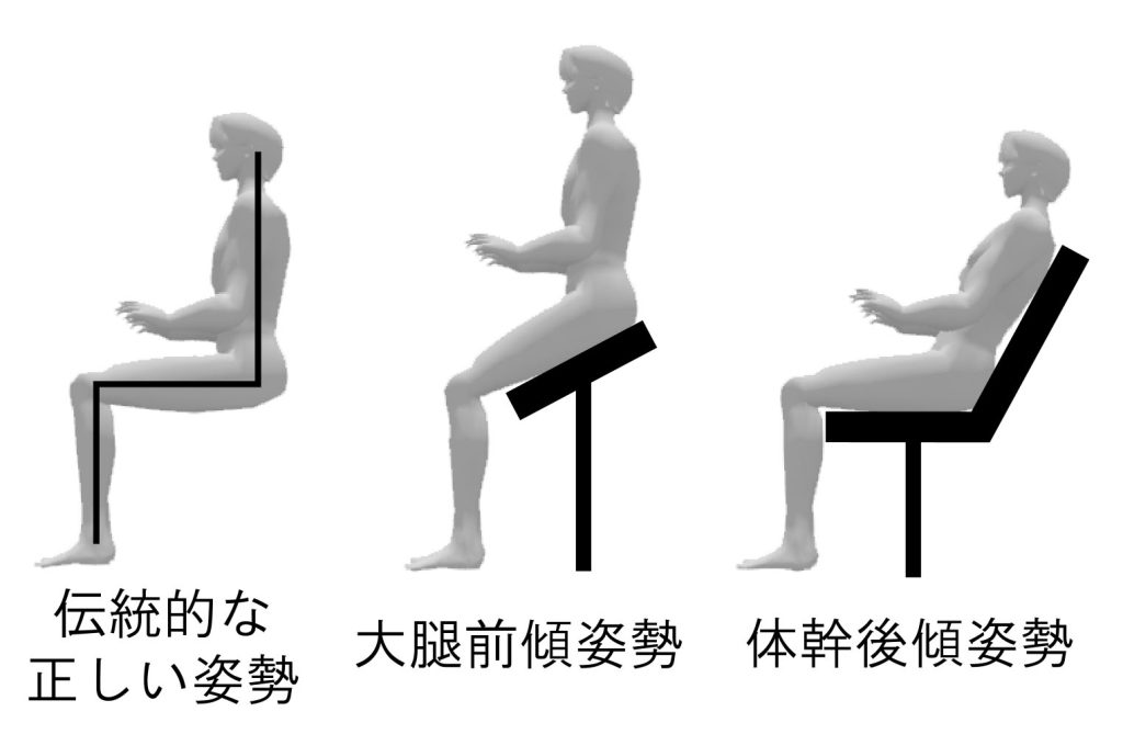 Thoái hóa đốt sống cổ: Căn bệnh 'văn phòng' và cách phòng ngừa hiệu quả
